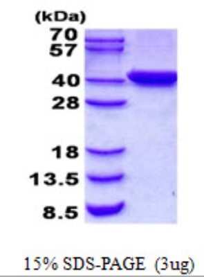 SDS-Page: TYW5 Protein [NBP2-22891]