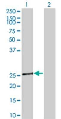 Western Blot: Tafazzin/TAZ Antibody (1F9) [H00006901-M15] - Analysis of TAZ expression in transfected 293T cell line by TAZ monoclonal antibody (M15), clone 1F9. Lane 1: TAZ transfected lysatE (28.5 KDa). Lane 2: Non-transfected lysate.