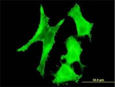 Immunocytochemistry/Immunofluorescence: Tafazzin/TAZ Antibody (3C10) [H00006901-M19] - Analysis of monoclonal antibody to TAZ on HeLa cell. Antibody concentration 10 ug/ml