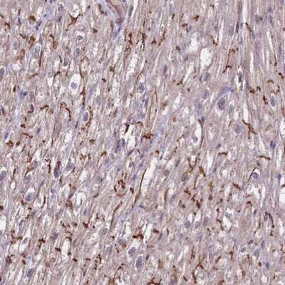 Immunohistochemistry-Paraffin: Tafazzin/TAZ Antibody [NBP1-88511] - Staining of human heart muscle shows moderate cytoplasmic positivity in cardiomyocytes.