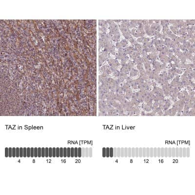 Immunohistochemistry-Paraffin: Tafazzin/TAZ Antibody [NBP1-88511] - Staining in human spleen and liver tissues.. Corresponding TAZ RNA-seq data are presented for the same tissues.