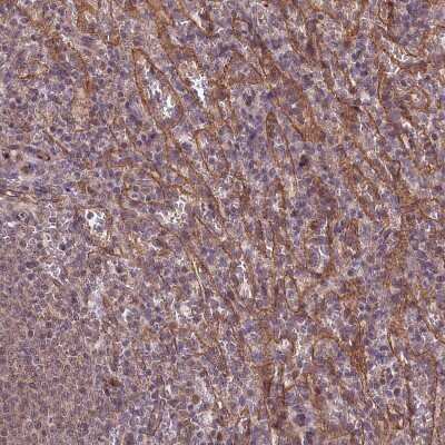 Immunohistochemistry-Paraffin: Tafazzin/TAZ Antibody [NBP1-88511] - Staining of human spleen shows moderate membranous positivity in cells in red pulp.