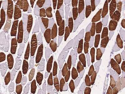 Immunohistochemistry-Paraffin: Tafazzin/TAZ Antibody [NBP2-98750] - Immunochemical staining of human Tafazzin/TAZ in human skeletal muscle with rabbit polyclonal antibody (1:10000, formalin-fixed paraffin embedded sections).