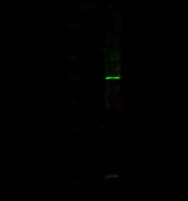 Western Blot: Tafazzin/TAZ Antibody [NBP2-98750] - Anti-Tafazzin/TAZ rabbit polyclonal antibody at 1:500 dilution. Lane A: A549 Whole Cell Lysate. Lysates/proteins at 30 ug per lane. Secondary Goat Anti-Rabbit IgG H&L (Dylight 800) at 1/10000 dilution. Developed using the Odyssey technique. Performed under reducing conditions. Predicted band size: 44 kDa. Observed band size: 40 kDa (We are unsure as to the identity of these extra bands).