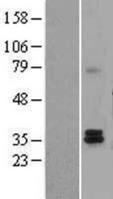 Western Blot: Tafazzin/TAZ Overexpression Lysate (Adult Normal) [NBL1-16718] Left-Empty vector transfected control cell lysate (HEK293 cell lysate); Right -Over-expression Lysate for Tafazzin/TAZ.