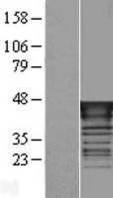 Western Blot: Tal1 Overexpression Lysate (Adult Normal) [NBP2-08031] Left-Empty vector transfected control cell lysate (HEK293 cell lysate); Right -Over-expression Lysate for Tal1.