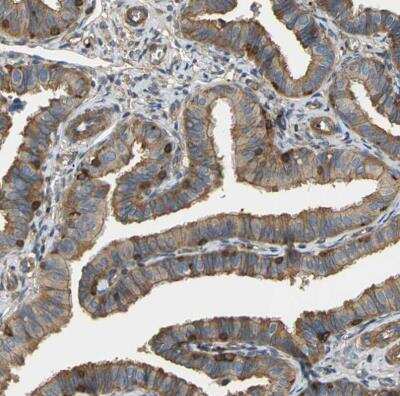 Immunohistochemistry-Paraffin Talin1 Antibody