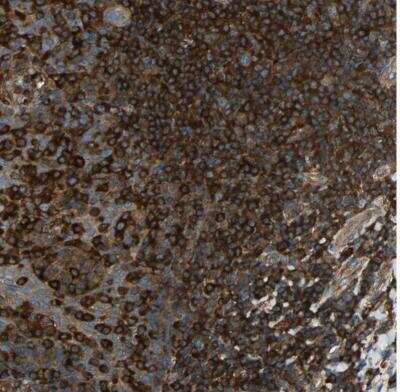 Immunohistochemistry-Paraffin Talin1 Antibody