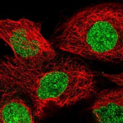 Immunocytochemistry/Immunofluorescence: Tankyrase 1 Antibody [NBP1-80947] - Staining of human cell line A-431 shows localization to nucleoplasm & nuclear membrane. Antibody staining is shown in green.