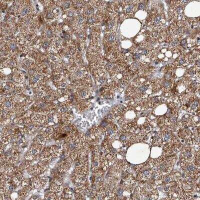 Immunohistochemistry-Paraffin: Tankyrase 1 Antibody [NBP1-80947] - Staining of human liver shows moderate cytoplasmic positivity in hepatocytes.