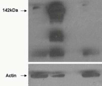 Western Blot: Tankyrase 1 Antibody [NBP1-36994] - HEK293 overexpressing TANK1 (lane 2) and TANK2 (lane 4) and probed with EB02508 (mock transfection in first lane). Lane three is empty. Lower panel shows the same lysates probed for alpha-Actin to show protein levels. Primary incubation (0.5ug/ml) was overnight at 4 degrees C. Detected by chemiluminescence.