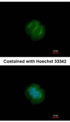 Immunocytochemistry/Immunofluorescence: Tankyrase Antibody [NBP2-20559] - Analysis of paraformaldehyde-fixed MCF-7, using antibody at 1:200 dilution.