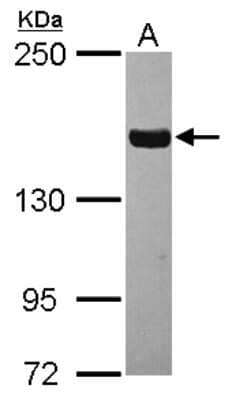 Western Blot: Tankyrase Antibody [NBP2-20559] - Sample (30 ug of whole cell lysate) A: U87-MG 5% SDS PAGE gel, diluted at 1:1000.