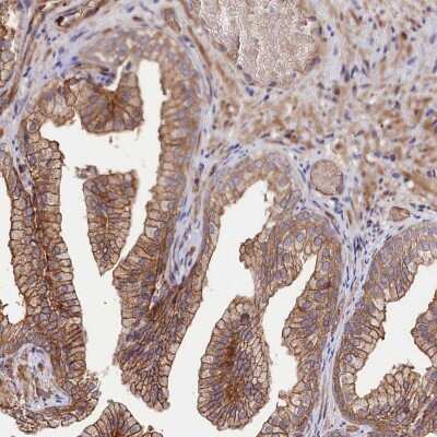 Immunohistochemistry: Tankyrase binding protein 1 Antibody [NBP2-34041] - Staining of human prostate shows distinct cytoplasmic and membranous positivity in glandular cells.