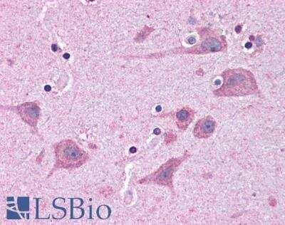 Immunohistochemistry-Paraffin: Tankyrase binding protein 1 Antibody [NB300-988] - Staining of paraffin embedded Human Cortex. Steamed antigen retrieval with citrate buffer pH 6, AP-staining.