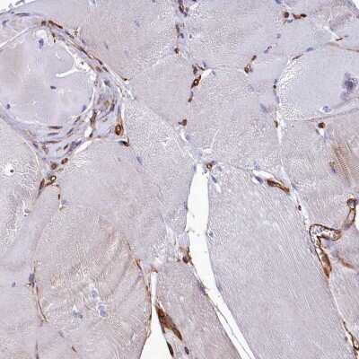 Immunohistochemistry-Paraffin: Tankyrase binding protein 1 Antibody [NBP1-89826] - Staining of human skeletal muscle shows low expression as expected.
