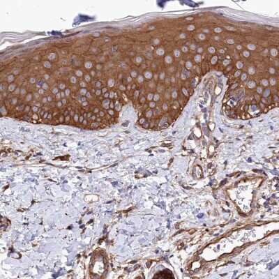 Immunohistochemistry-Paraffin: Tankyrase binding protein 1 Antibody [NBP1-89826] - Staining of human skin shows high expression.