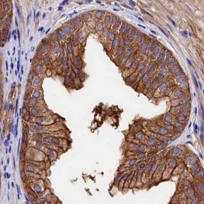 Immunohistochemistry-Paraffin: Tankyrase binding protein 1 Antibody [NBP1-89826] - Staining of human prostate.