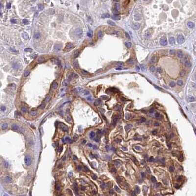 Immunohistochemistry-Paraffin: Tankyrase binding protein 1 Antibody [NBP1-89826] - Staining of human kidney.