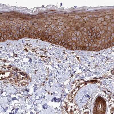 Immunohistochemistry-Paraffin: Tankyrase binding protein 1 Antibody [NBP2-34041] - Staining of human skin shows high expression.
