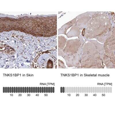 <b>Orthogonal Strategies Validation. </b>Immunohistochemistry-Paraffin: Tankyrase binding protein 1 Antibody [NBP2-34041] - Staining in human skin and skeletal muscle tissues using anti-TNKS1BP1 antibody. Corresponding TNKS1BP1 RNA-seq data are presented for the same tissues.