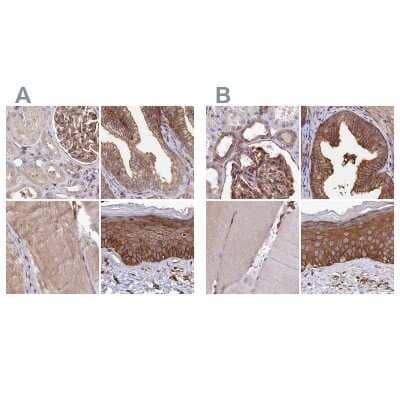 <b>Independent Antibodies Validation. </b>Immunohistochemistry-Paraffin: Tankyrase binding protein 1 Antibody [NBP2-34041] - Staining of human kidney, prostate, skeletal muscle and skin using Anti-TNKS1BP1 antibody NBP2-34041 (A) shows similar protein distribution across tissues to independent antibody NBP1-89826 (B).