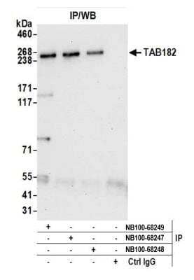 <b>Independent Antibodies Validation. </b>Immunoprecipitation: Tankyrase binding protein 1 Antibody [NB100-68249] - Detection of human TAB182 (Tankyrase binding protein 1) by western blot of immunoprecipitates. Samples: Whole cell lysate (0.5 or 1.0 mg per IP reaction; 20% of IP loaded) from HeLa cells prepared using NETN lysis buffer. Antibodies: Affinity purified rabbit anti-TAB182 antibody NB100-68249 used for IP at 6 ug per reaction. TAB182 was also immunoprecipitated by rabbit anti-TAB182 antibodies NB100-68247 and NB100-68248. For blotting immunoprecipitated TAB182, NB100-68249 was used at 1 ug/ml. Detection: Chemiluminescence with an exposure time of 3 minutes.