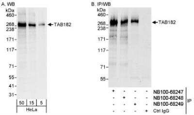 Western Blot: Tankyrase binding protein 1 Antibody [NB100-68247] - Detection of Human TAB182 on HeLa whole cell lysate using NB100-68247. TAB182 was also  immunoprecipitated by rabbit anti-TAB182 antibodies NB100-68248 and NB100-68249.