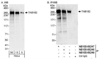 Western Blot: Tankyrase binding protein 1 Antibody [NB100-68248] - Detection of Human TAB182 on HeLa whole cell lysate using NB100-68248. TAB182 was also immunoprecipitated by rabbit anti-TAB182 antibodies NB100-68247 and NB100-68249.