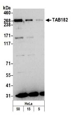 Western Blot: Tankyrase binding protein 1 Antibody [NB100-68249] - Detection of Human TAB182 by Western Blot. Samples: Whole cell lysate (5, 15 and 50 ug) from HeLa cells prepared using NETN lysis buffer. Antibody: Affinity purified rabbit anti-TAB182 antibody NB100-68249 used for WB at 0.1 ug/ml. Detection: Chemiluminescence with an exposure time of 3 minutes.