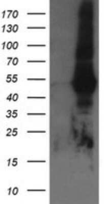 Western Blot: Tapasin Related Protein Antibody (OTI4H5) - Azide and BSA Free [NBP2-74443] - Analysis of HEK293T cells were transfected with the pCMV6-ENTRY control (Left lane) or pCMV6-ENTRY Tapasin Related Protein.