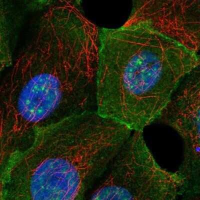 Immunocytochemistry/Immunofluorescence: Tau Antibody [NBP2-54932] - Staining of human cell line MCF7 shows localization to nuclear speckles & plasma membrane.