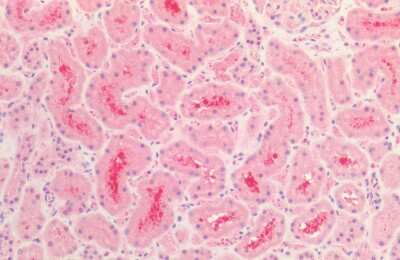 Immunohistochemistry: Tau Antibody [NBP3-18237] - Immunohistochemistry analysis using Rabbit Anti-Tau Polyclonal Antibody (NBP3-18237). Tissue: Kidney. Species: Human. Fixation: Formalin fixed paraffin-embedded. Primary Antibody: Rabbit Anti-Tau Polyclonal Antibody (NBP3-18237).
