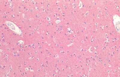 Immunohistochemistry: Tau Antibody [NBP3-18238] - Immunohistochemistry analysis using Rabbit Anti-Tau Polyclonal Antibody (NBP3-18238). Tissue: Brain Cortex. Species: Human. Fixation: Formalin fixed paraffin-embedded. Primary Antibody: Rabbit Anti-Tau Polyclonal Antibody (NBP3-18238).