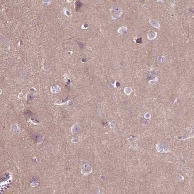 Immunohistochemistry-Paraffin: Tau Antibody [NBP2-49607] - Staining of human cerebral cortex shows high expression.
