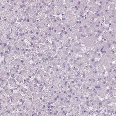 <b>Orthogonal Strategies Validation. </b>Immunohistochemistry-Paraffin: Tau Antibody [NBP2-49607] - Staining of human liver shows low expression as expected.