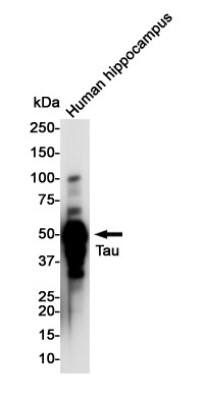 Western Blot: Tau Antibody (S03-9I2) [NBP3-20059] - Western blot detection of Tau in Human Hippocampus lysates using NBP3-20059 (1:1000 diluted). Predicted band size: 79KDa. Observed band size: 50-80KDa.