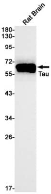Western Blot: Tau Antibody (S09-5E2) [NBP3-20020] - Western blot detection of Tau in Rat Brain cell using NBP3-20020 (1:1000 diluted). Predicted band size: 79kDa. Observed band size: 50-80kDa.