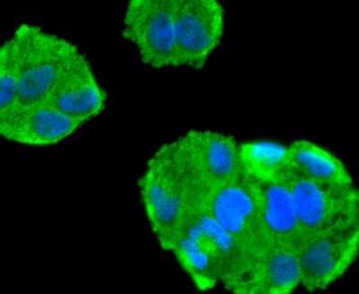Immunocytochemistry/Immunofluorescence: Tau Antibody (SD205-09) [NBP2-67774] - Staining Tau in Hela cells (green). The nuclear counter stain is DAPI (blue). Cells were fixed in paraformaldehyde, permeabilised with 0.25% Triton X100/PBS.