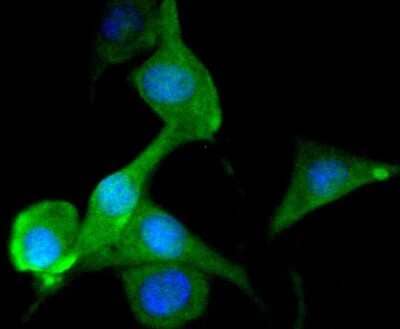 Immunocytochemistry/Immunofluorescence: Tau Antibody (SD205-09) [NBP2-67774] - Staining Tau in SHG-44 cells (green). The nuclear counter stain is DAPI (blue). Cells were fixed in paraformaldehyde, permeabilised with 0.25% Triton X100/PBS.