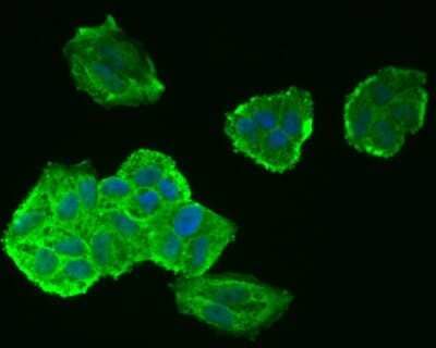 Immunocytochemistry/Immunofluorescence: Tau Antibody (SD205-09) [NBP2-67774] - ICC staining of Tau in Hela cells (green). Formalin fixed cells were permeabilized with 0.1% Triton X-100 in TBS for 10 minutes at room temperature and blocked with 1% Blocker BSA for 15 minutes at room temperature. Cells were probed with the primary antibody (1/50) for 1 hour at room temperature, washed with PBS. Alexa Fluor(R)488 Goat anti-Rabbit IgG was used as the secondary antibody at 1/1,000 dilution. The nuclear counter stain is DAPI (blue).