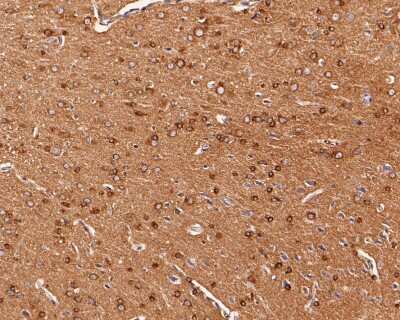 Immunohistochemistry-Paraffin: Tau Antibody (SD205-09) [NBP2-67774] - Analysis of paraffin-embedded rat brain tissue with Rabbit anti-Tau antibody washed with ddH2O and PBS, and then probed with the primary antibody  at 1/200 dilution for 1 hour at room temperature. The detection was performed using an HRP conjugated compact polymer system. DAB was used as the chromogen. Tissues were counterstained with hematoxylin and mounted with DPX.