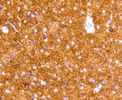 Immunohistochemistry-Paraffin: Tau Antibody (SZ03-03) [NBP2-67357] - Analysis of paraffin-embedded rat brain tissue using anti-Tau antibody. Counter stained with hematoxylin.