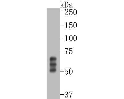 Western Blot: Tau Antibody (SZ03-03) [NBP2-67357] - Western blot analysis of Tau on rat brain tissue lysates. Proteins were transferred to a PVDF membrane and blocked with 5% BSA in PBS for 1 hour at room temperature. The primary antibody (1/500) was used in 5% BSA at room temperature for 2 hours. Goat Ant