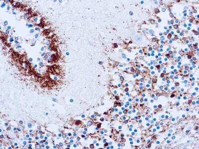 Immunohistochemistry-Paraffin: Tau Antibody (Tau46) [NBP2-42223] - Formalin fixed paraffin embedded human brain tissue stained with Tau antibody (NBP2-42223).