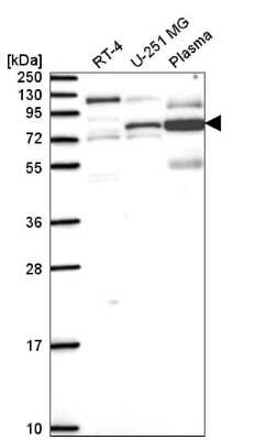 Western Blot: Tau Antibody [NBP2-54932] - Western blot analysis in human cell line RT-4, human cell line U-251 MG and human plasma.