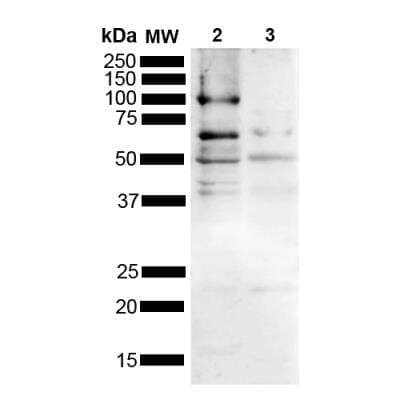 Western Blot: Tau Antibody [NBP3-11044] - Western blot analysis of Mouse, Rat Brain showing detection of Multiple bands due to different isoforms/aggregation states Tau protein using Rabbit Anti-Tau Polyclonal Antibody. Lane 1: MW Ladder. Lane 2: Mouse brain (15 ug). Lane 2: Rat brain (15 ug). Load: 15 ug. Block: 5% Skim Milk powder in TBST. Primary Antibody: Rabbit Anti-Tau Polyclonal Antibody at 1:1000 for 2 hours at RT with shaking. Secondary Antibody: Goat anti-rabbit IgG:HRP at 1:4000 for 1 hour at RT with shaking . Color Development: Chemiluminescent for HRP (Moss) for 5 min in RT. Predicted/Observed Size: Multiple bands due to different isoforms/aggregation states. Other Band(s): 50 kDa, 65 kDa, 100 kDa.