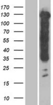 Western Blot: Tau Overexpression Lysate (Adult Normal) [NBP2-06993] Left-Empty vector transfected control cell lysate (HEK293 cell lysate); Right -Over-expression Lysate for Tau.