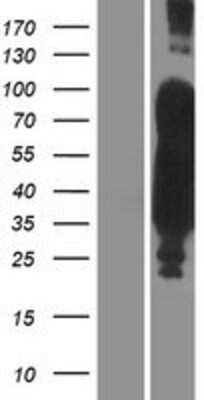 Western Blot Tau Overexpression Lysate