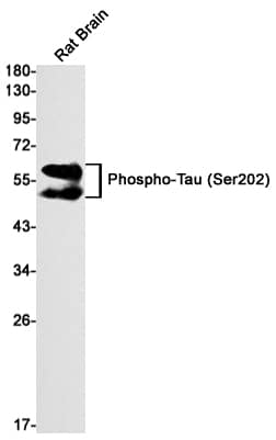 Western Blot: Tau [p Ser202] Antibody (S01-5A7) [NBP3-20058] - Western blot detection of Tau in Rat Brain lysates using NBP3-20058 (1:1000 diluted). Predicted band size: 79kDa. Observed band size: 50-80kDa.